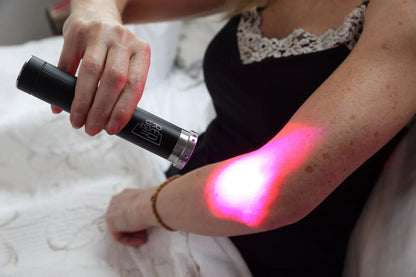 Woman applying combined red and blue light from the HeroTorch to her forearm