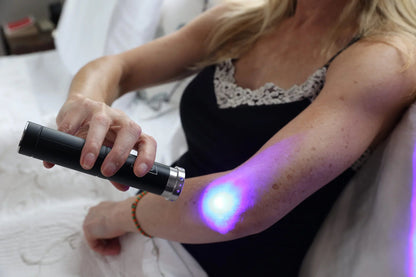 Woman applying blue light from the HeroTorch to her forearm
